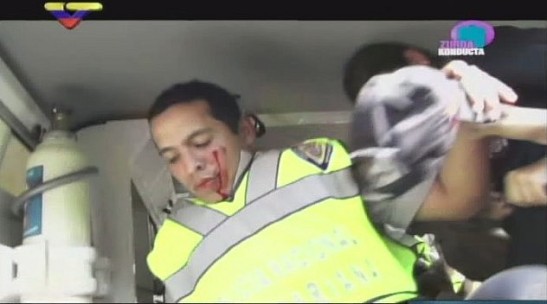 Funcionaria de la policía nacional herida durante manifestación opositora